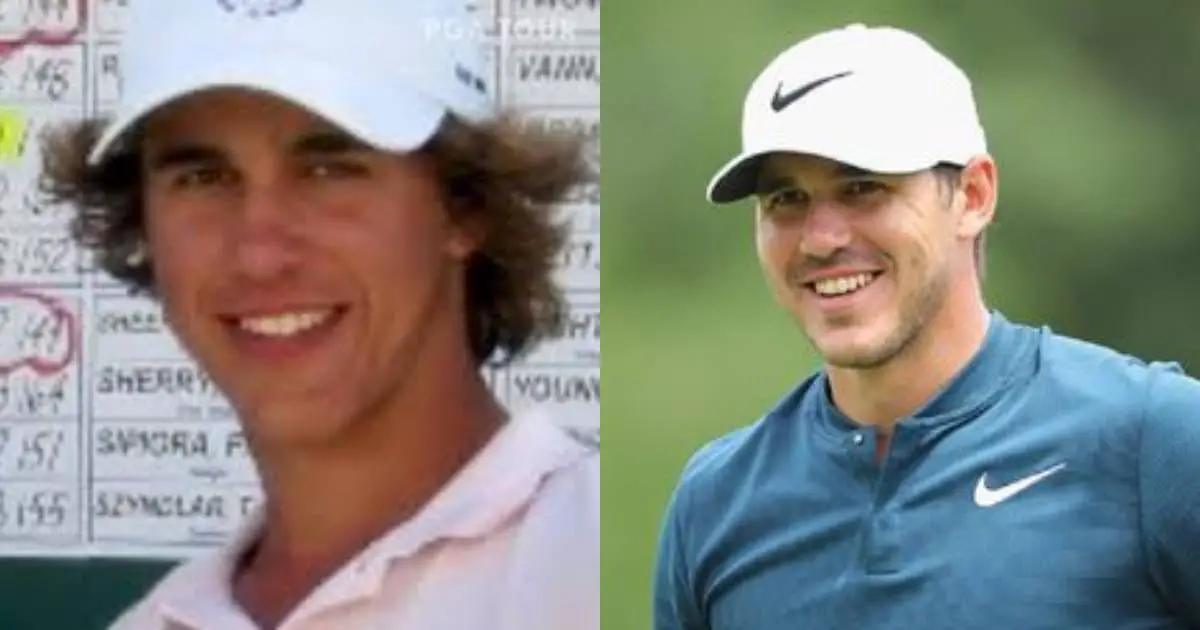 Did Brooks Koepka Get His Teeth Done? Check Before and After