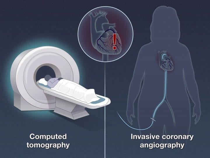 ct pan scan procedure: Easy steps? (The quick guide to understanding the process and what to expect with it)