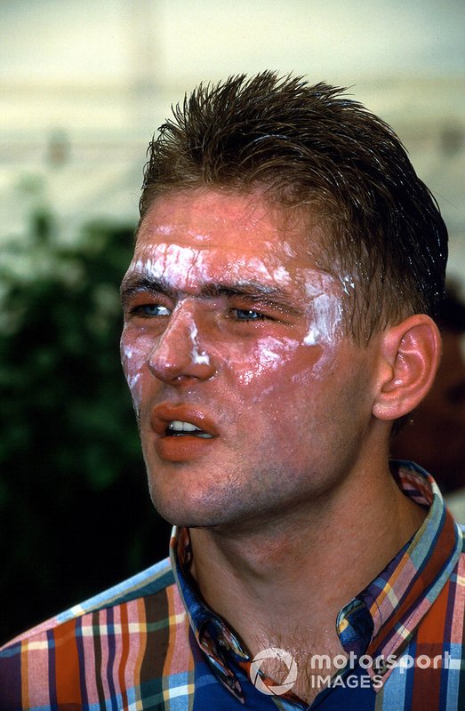 Jos Verstappen Fire: Was He Injured? (Everything You Need to Know Now)