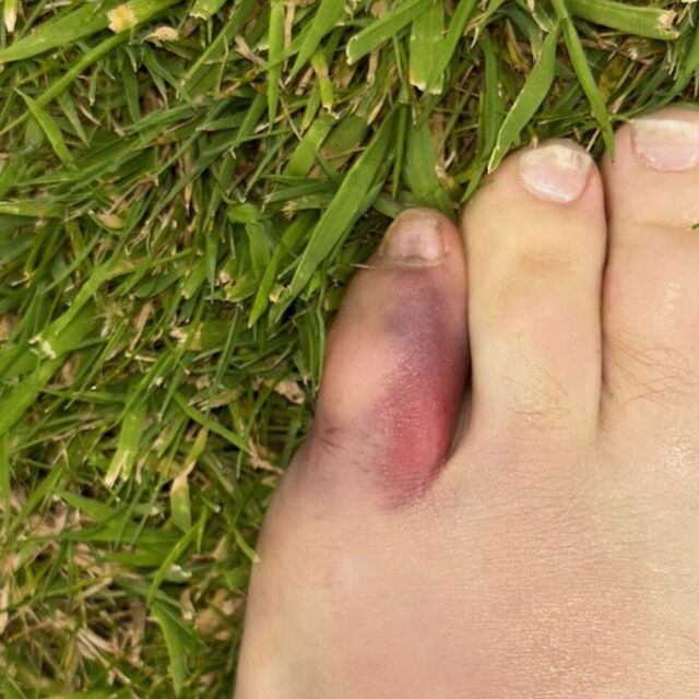 That McGregor Toe: Check the Latest update on Conors Condition