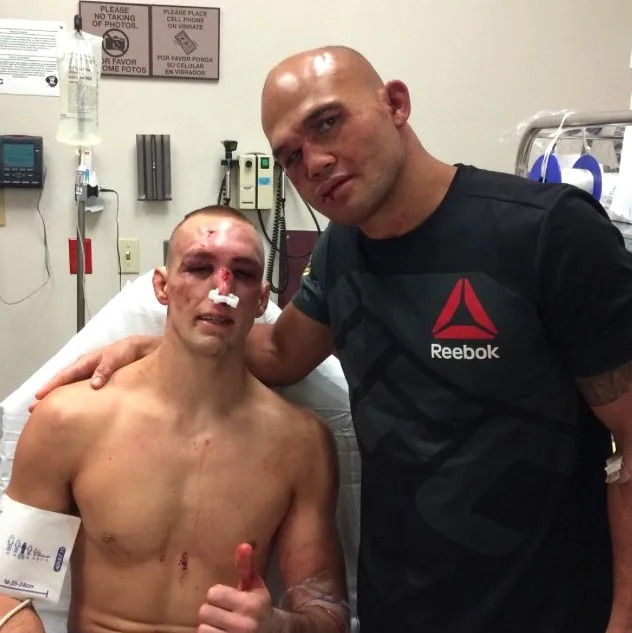 Is Rory Macdonald nose okay now? Latest updates on the fighters condition.