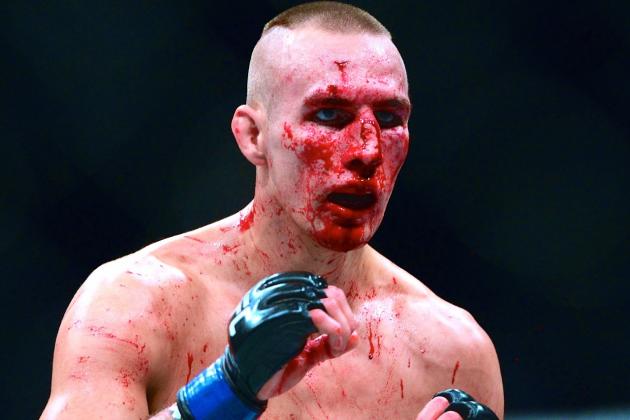 Is Rory Macdonald nose okay now? Latest updates on the fighters condition.