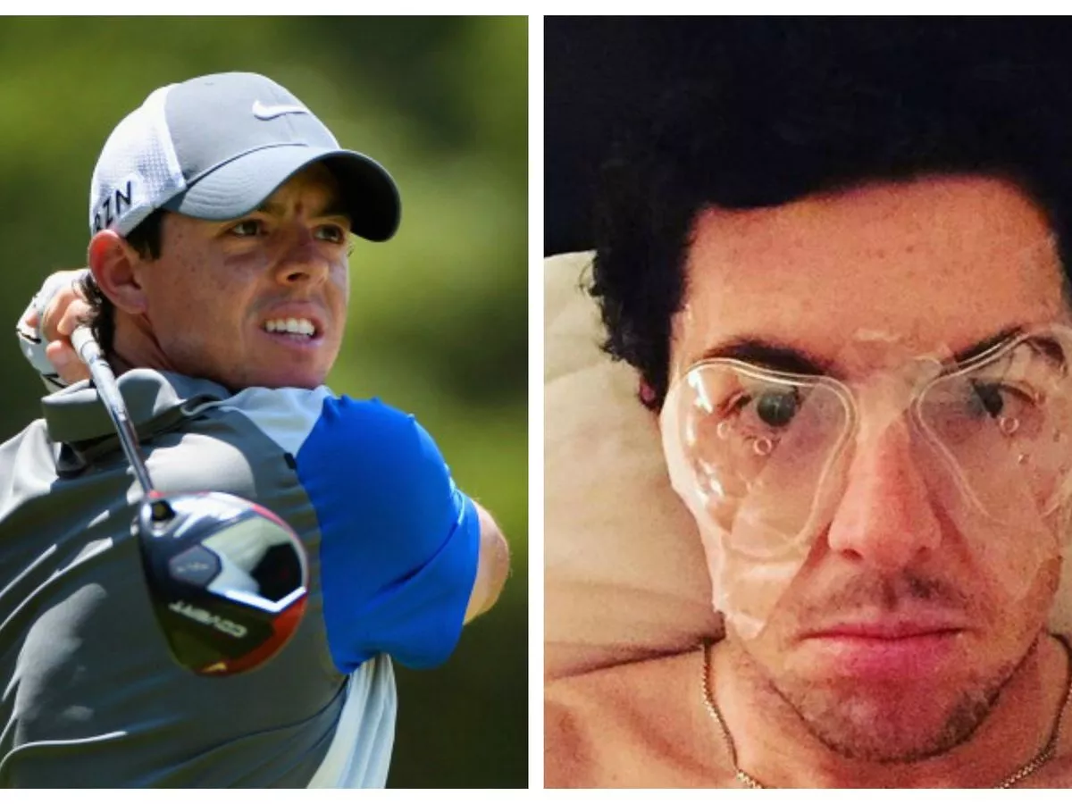 Whats the truth about Rory McIlroy plastic surgery? Fans want to know the details.