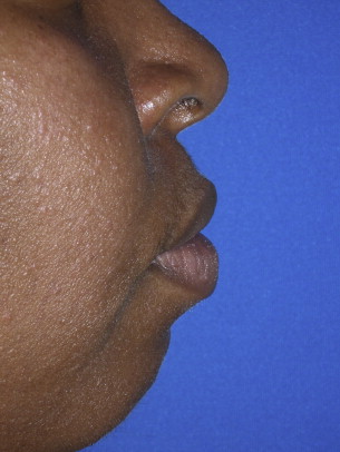 Why do Blacks have big lips? Heres an easy explanation you can truly understand.