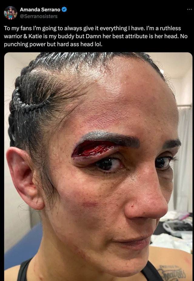 Girls fight last night eye: all the shocking details (What we know about the eye injury and aftermath)