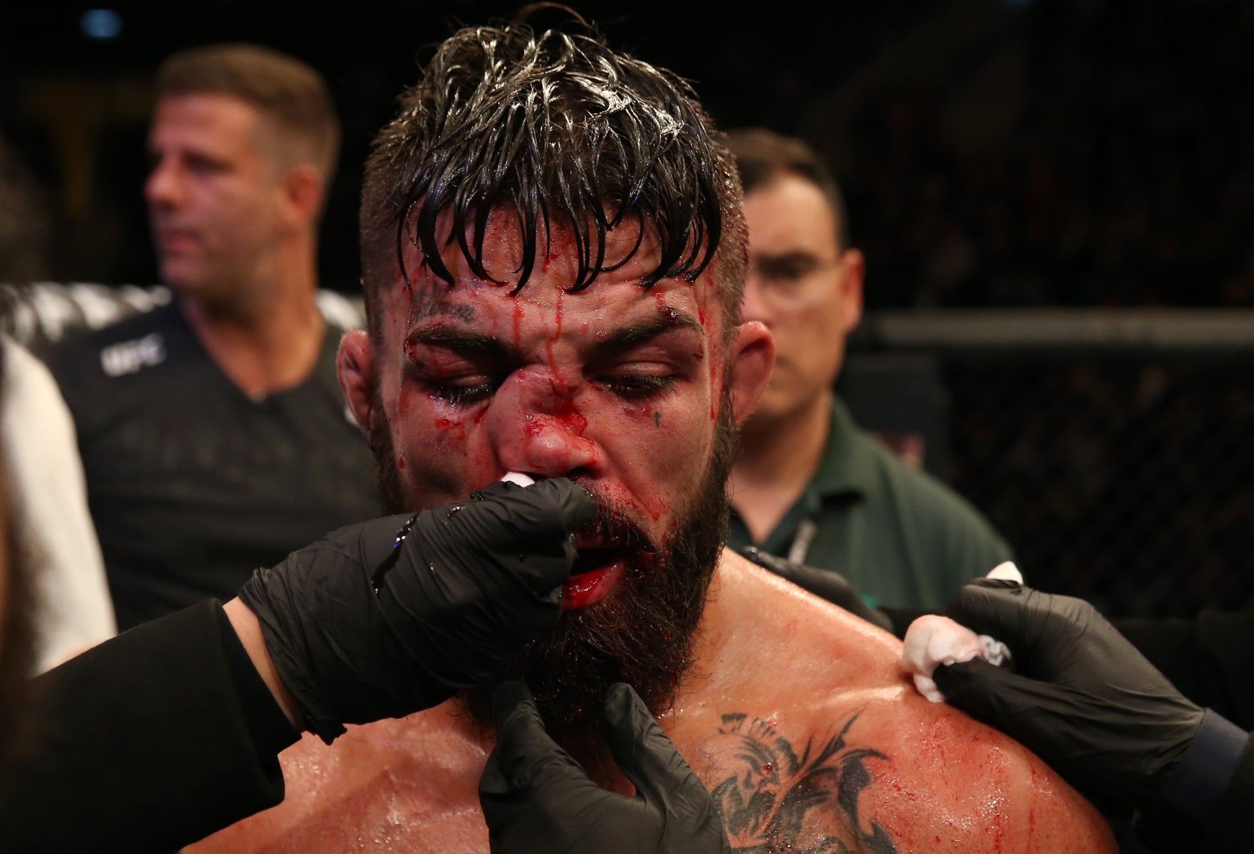 Mike Perry Nose Break: What Really Happened to Him?