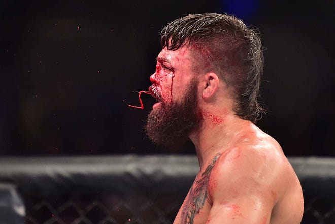 Mike Perry Nose Break: What Really Happened to Him?
