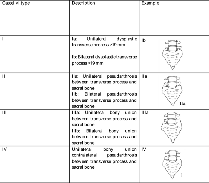 How to Identify Castellvi? Expert Diagnosis Tips and Methods